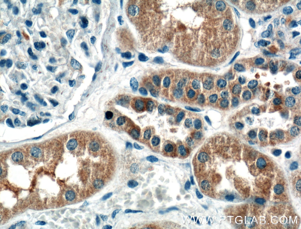 Immunohistochemistry (IHC) staining of human kidney tissue using IL-12A Monoclonal antibody (60324-1-Ig)