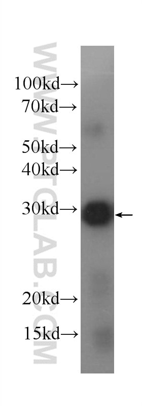 Western Blot (WB) analysis of Recombinant protein using IL-12A Monoclonal antibody (60324-1-Ig)