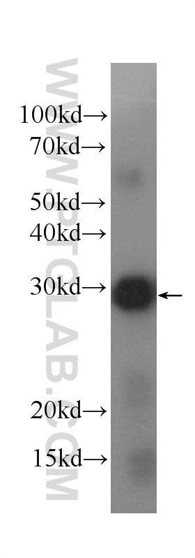 WB analysis of Recombinant protein using 60324-1-Ig