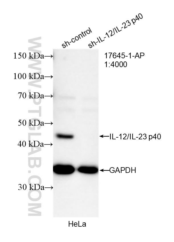 Western Blot (WB) analysis of HeLa cells using IL-12/IL-23 p40 Polyclonal antibody (17645-1-AP)