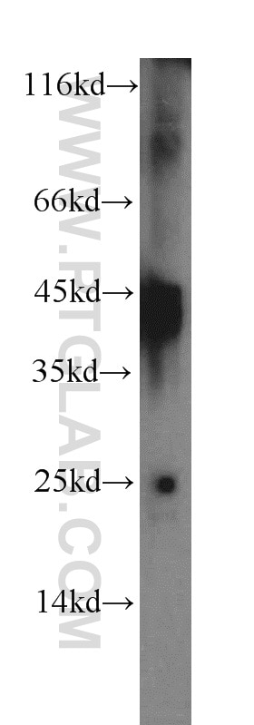 Western Blot (WB) analysis of Recombinant protein using IL-12B Polyclonal antibody (17645-1-AP)