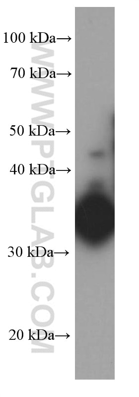 Western Blot (WB) analysis of human liver tissue using IL-12B Monoclonal antibody (66288-1-Ig)