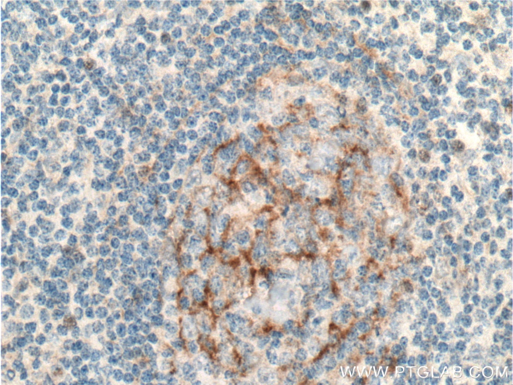 IHC staining of human tonsillitis using 13287-1-AP