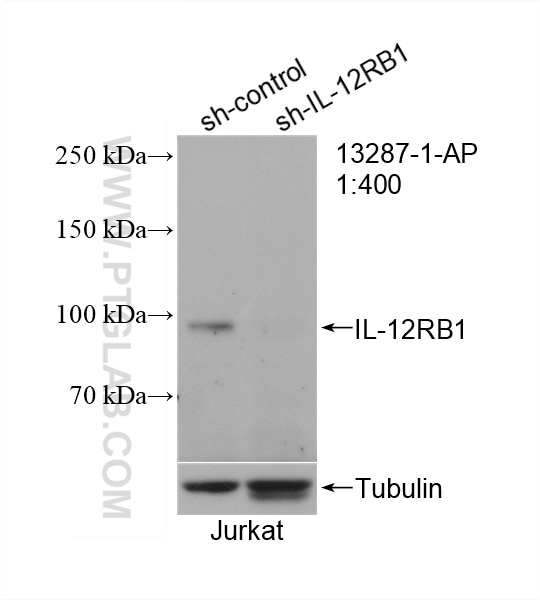 Western Blot (WB) analysis of Jurkat cells using IL-12RB1 Polyclonal antibody (13287-1-AP)