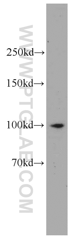 Western Blot (WB) analysis of K-562 cells using IL-12RB1 Polyclonal antibody (13287-1-AP)