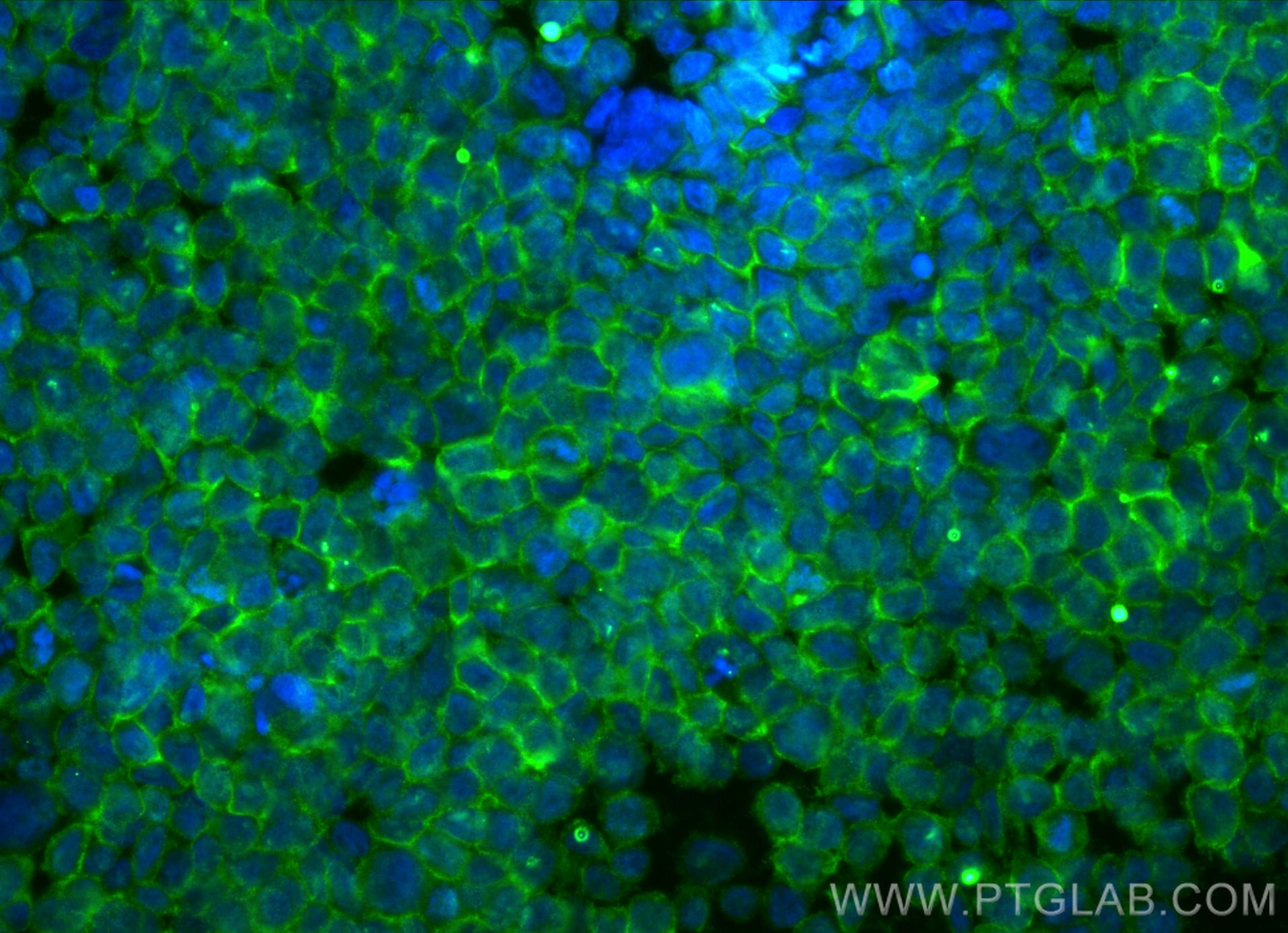 Immunofluorescence (IF) / fluorescent staining of THP-1 cells using IL-12RB1 Monoclonal antibody (66829-1-Ig)