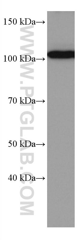 Western Blot (WB) analysis of Jurkat cells using IL-12RB1 Monoclonal antibody (66829-1-Ig)