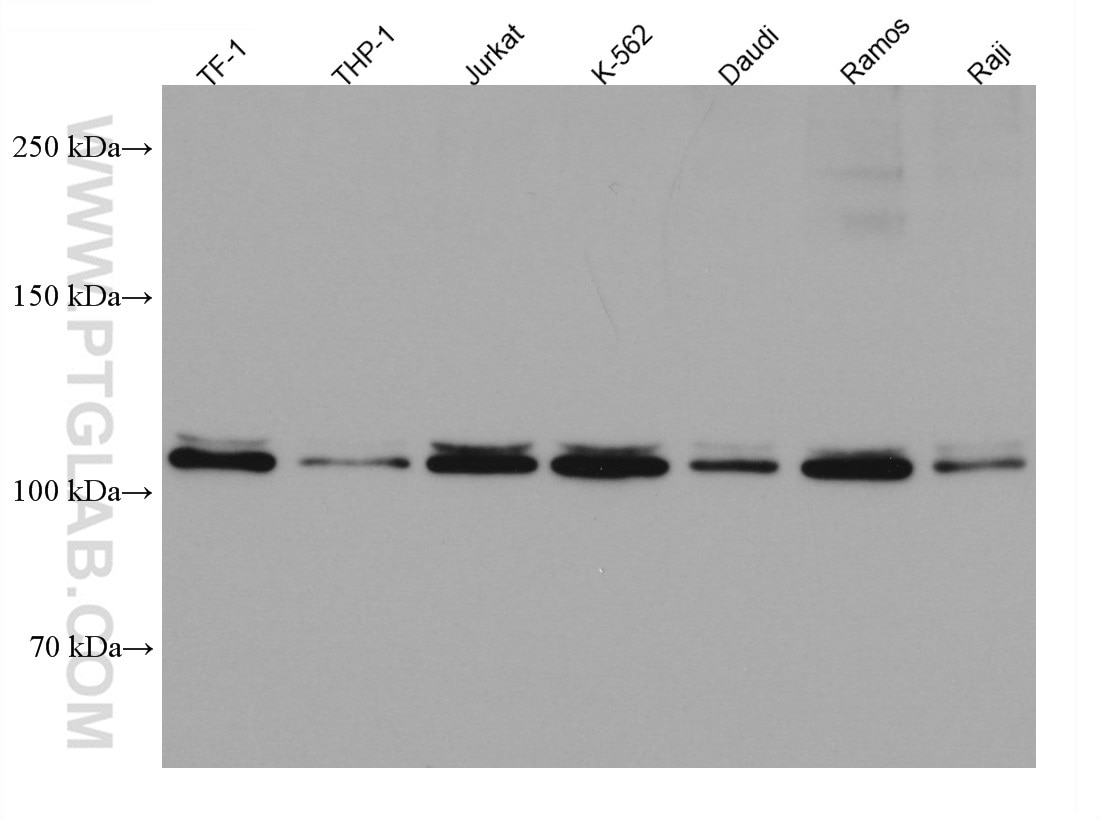 Western Blot (WB) analysis of various lysates using IL-12RB1 Monoclonal antibody (66829-1-Ig)