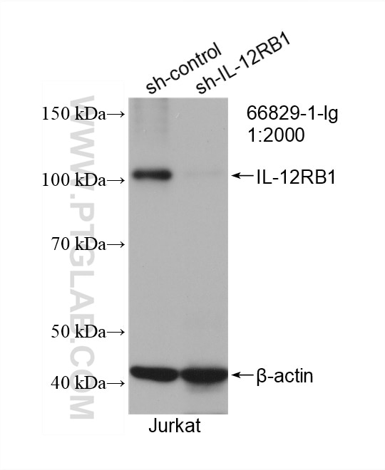 Western Blot (WB) analysis of Jurkat cells using IL-12RB1 Monoclonal antibody (66829-1-Ig)