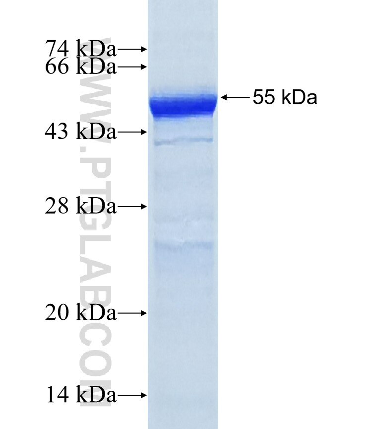 IL13RA1 fusion protein Ag34592 SDS-PAGE IL13RA1 fusion protein Ag34592 SDS-PAGE