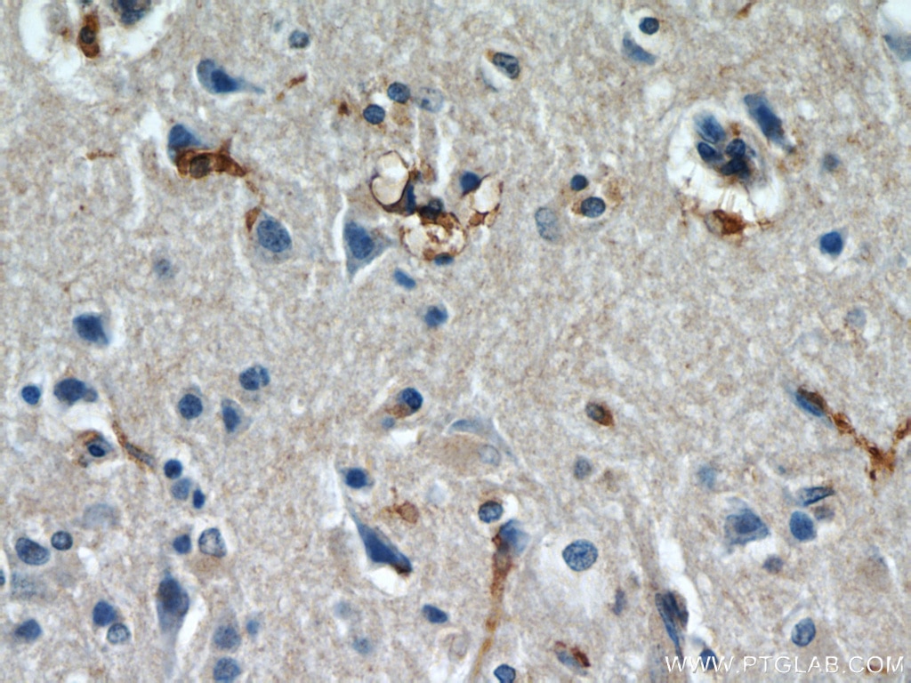 Immunohistochemistry (IHC) staining of human brain tissue using IL-13RA2 Polyclonal antibody (11059-1-AP)