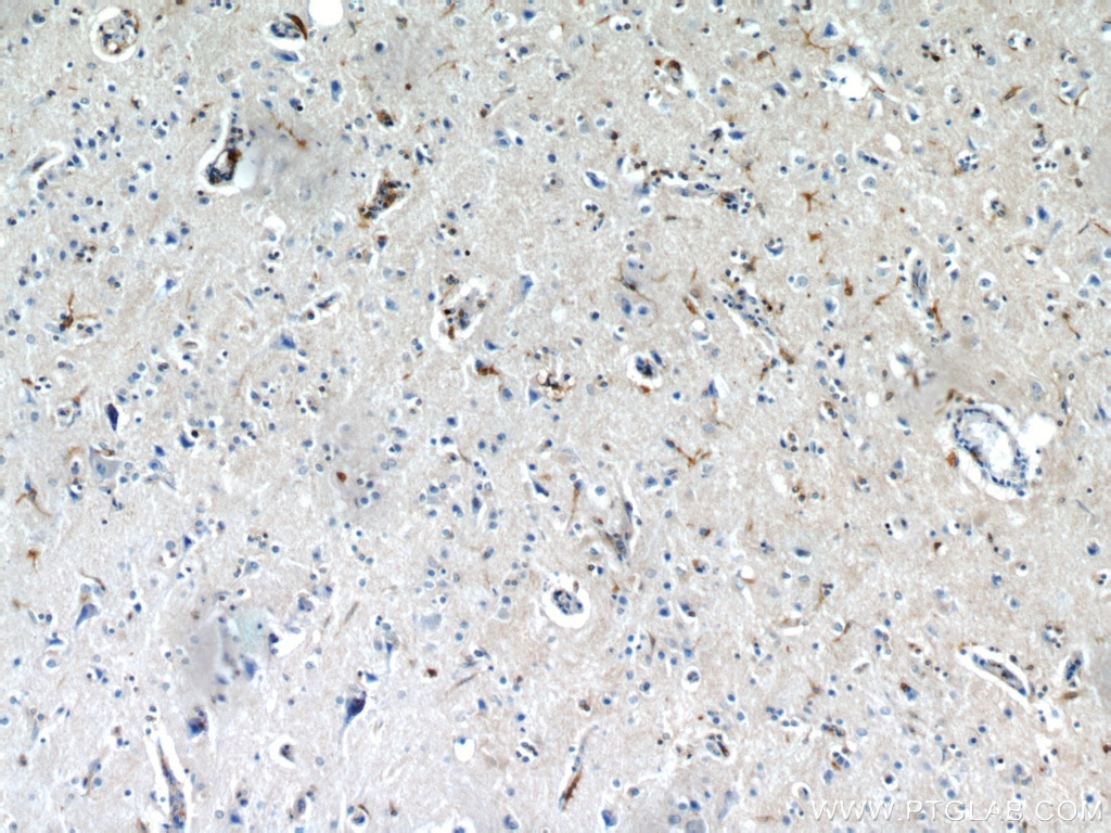 Immunohistochemistry (IHC) staining of human brain tissue using IL-13RA2 Polyclonal antibody (11059-1-AP)