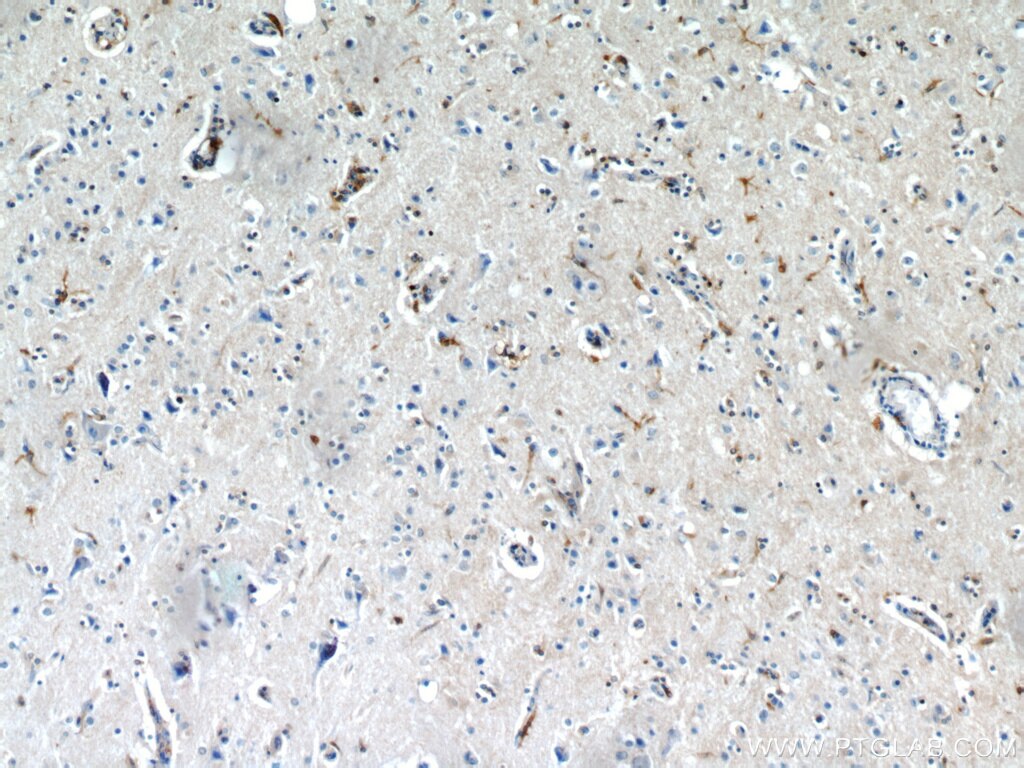 IHC staining of human brain using 11059-1-AP