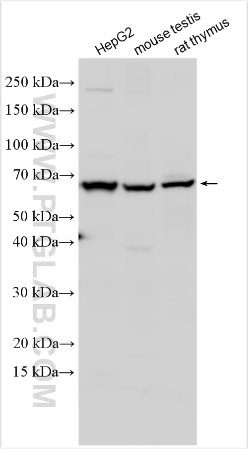 Western Blot (WB) analysis of various lysates using IL-13RA2 Polyclonal antibody (11059-1-AP)