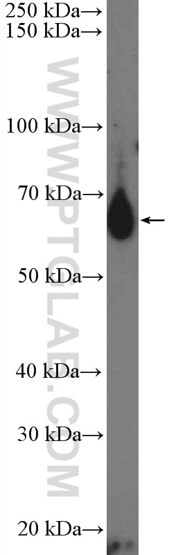 Western Blot (WB) analysis of rat thymus tissue using IL-13RA2 Polyclonal antibody (11059-1-AP)