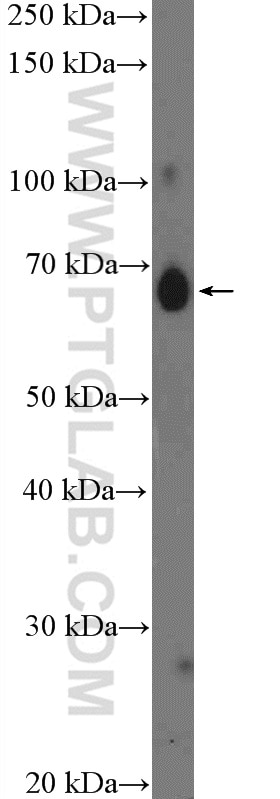 Western Blot (WB) analysis of rat liver tissue using IL-13RA2 Polyclonal antibody (11059-1-AP)