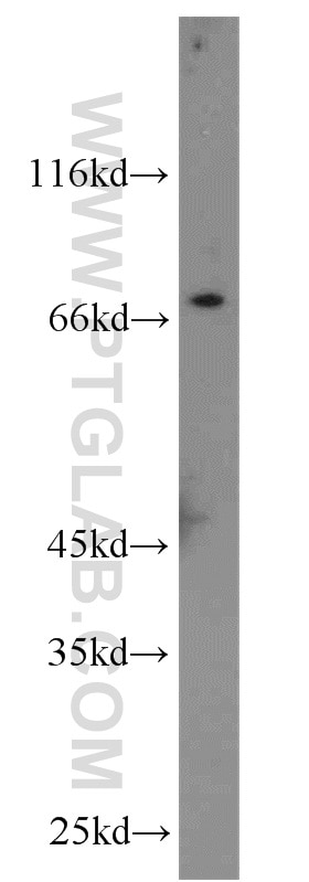 Western Blot (WB) analysis of HeLa cells using IL-13RA2 Polyclonal antibody (11059-1-AP)