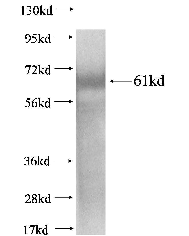 IL-13RA2 fusion protein Ag1534 SDS-PAGE