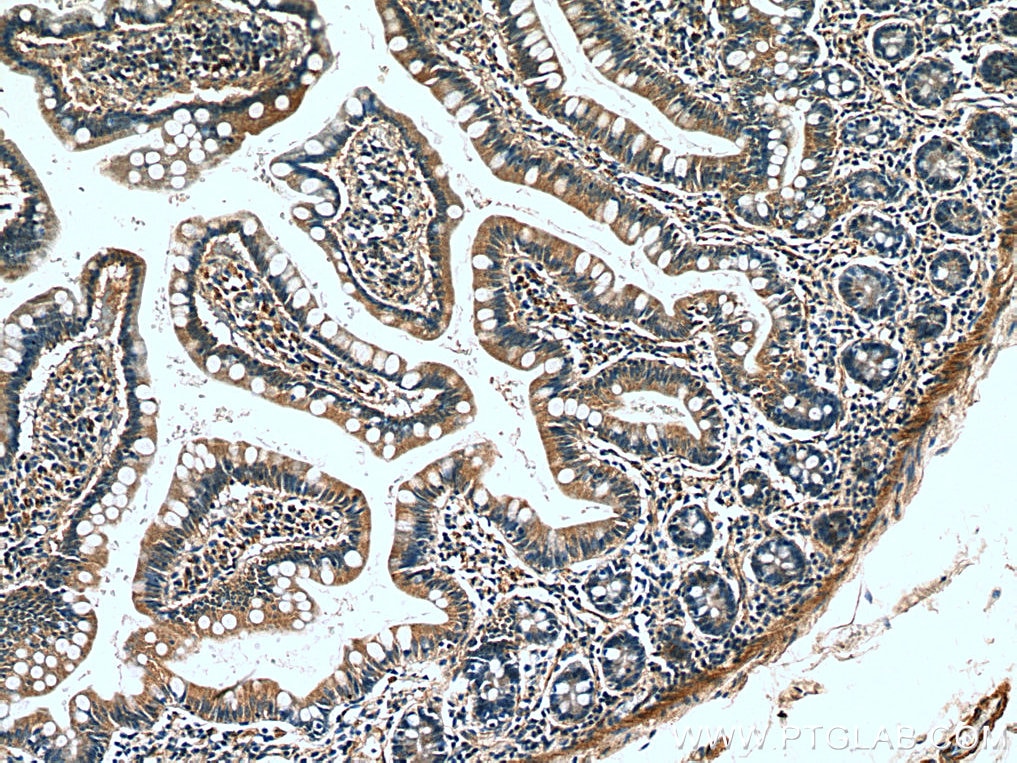 Immunohistochemistry (IHC) staining of human small intestine tissue using IL-15 Polyclonal antibody (28455-1-AP)