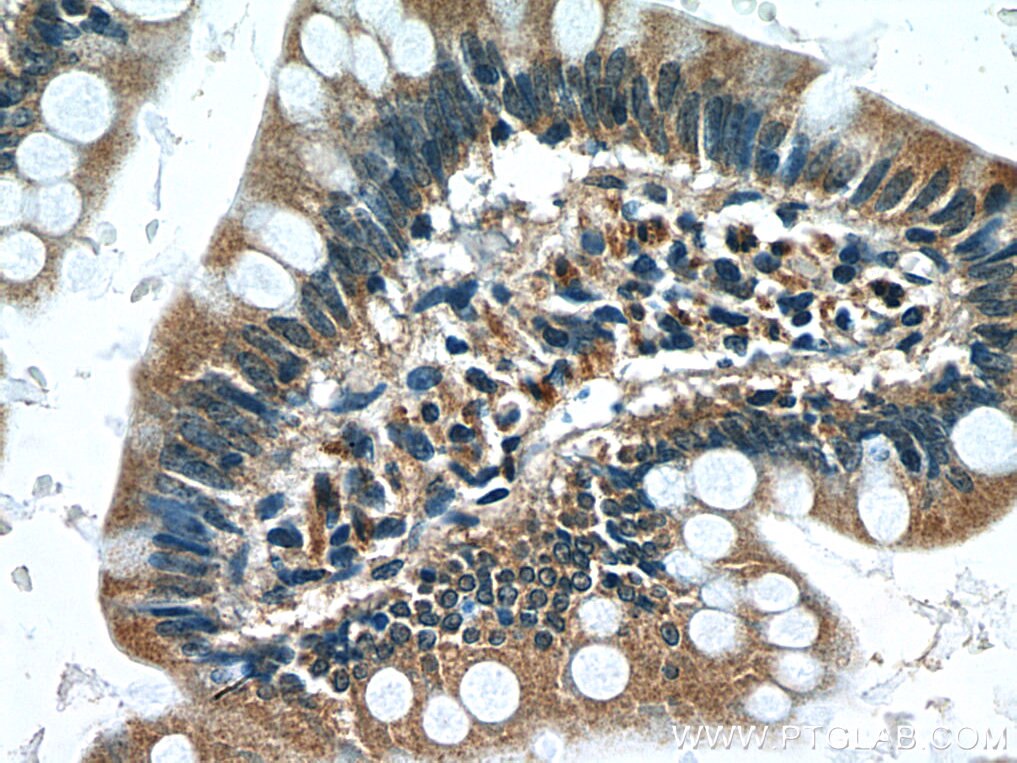 Immunohistochemistry (IHC) staining of human small intestine tissue using IL-15 Polyclonal antibody (28455-1-AP)