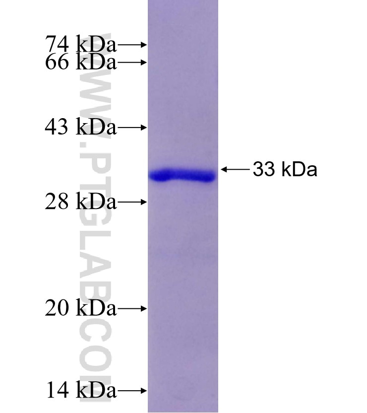 IL-15 fusion protein Ag29395 SDS-PAGE