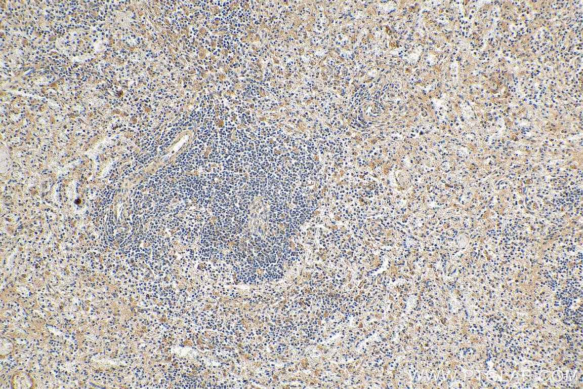 Immunohistochemistry (IHC) staining of human spleen tissue using IL-15RA Polyclonal antibody (16744-1-AP)