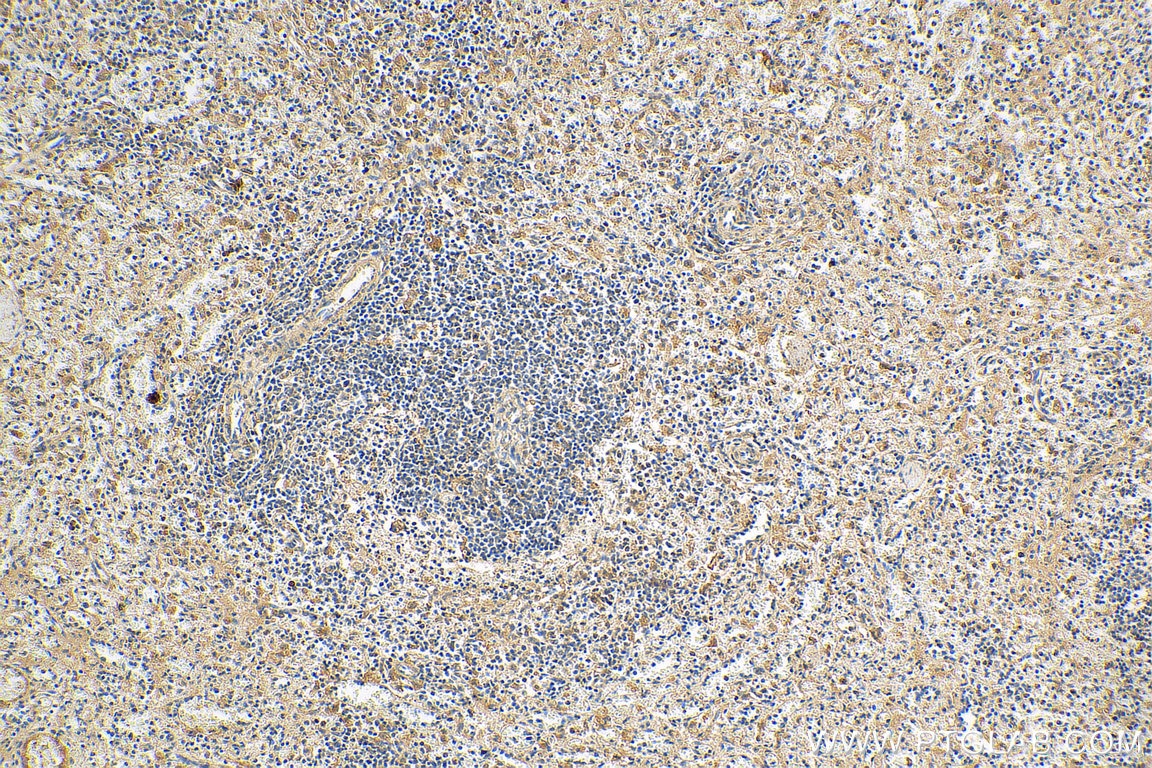 IHC staining of human spleen using 16744-1-AP