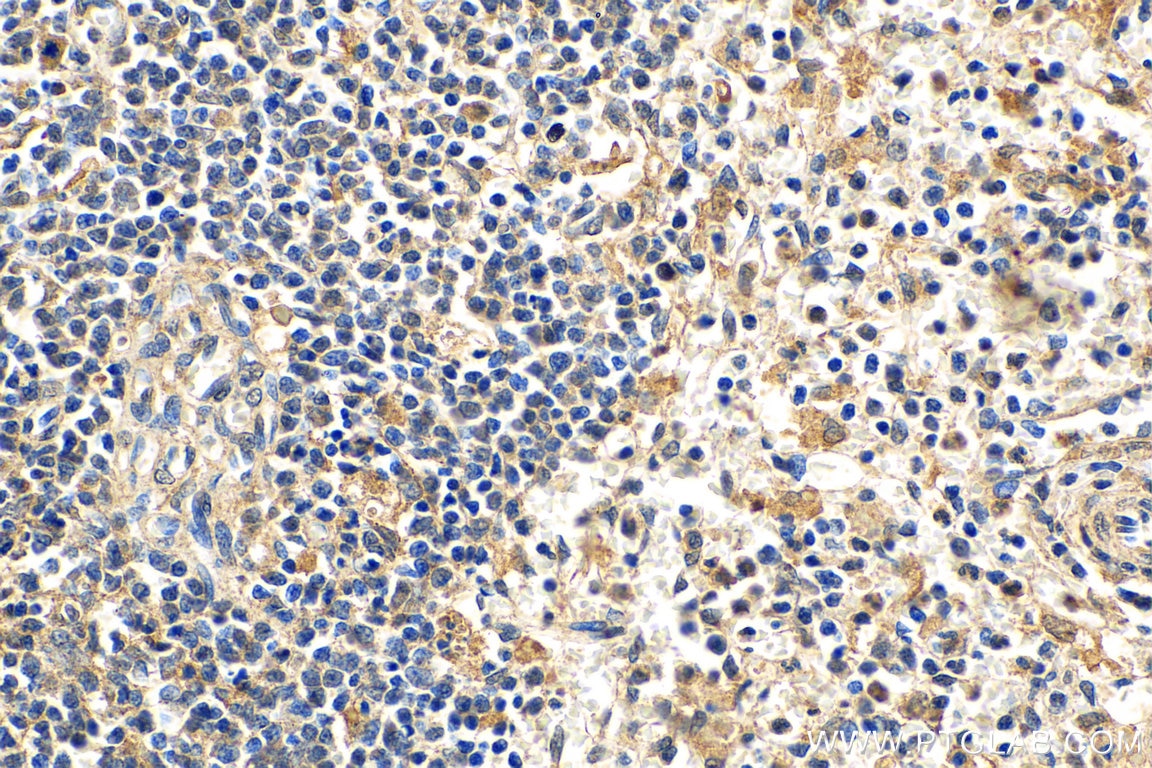 Immunohistochemistry (IHC) staining of human spleen tissue using IL-15RA Polyclonal antibody (16744-1-AP)