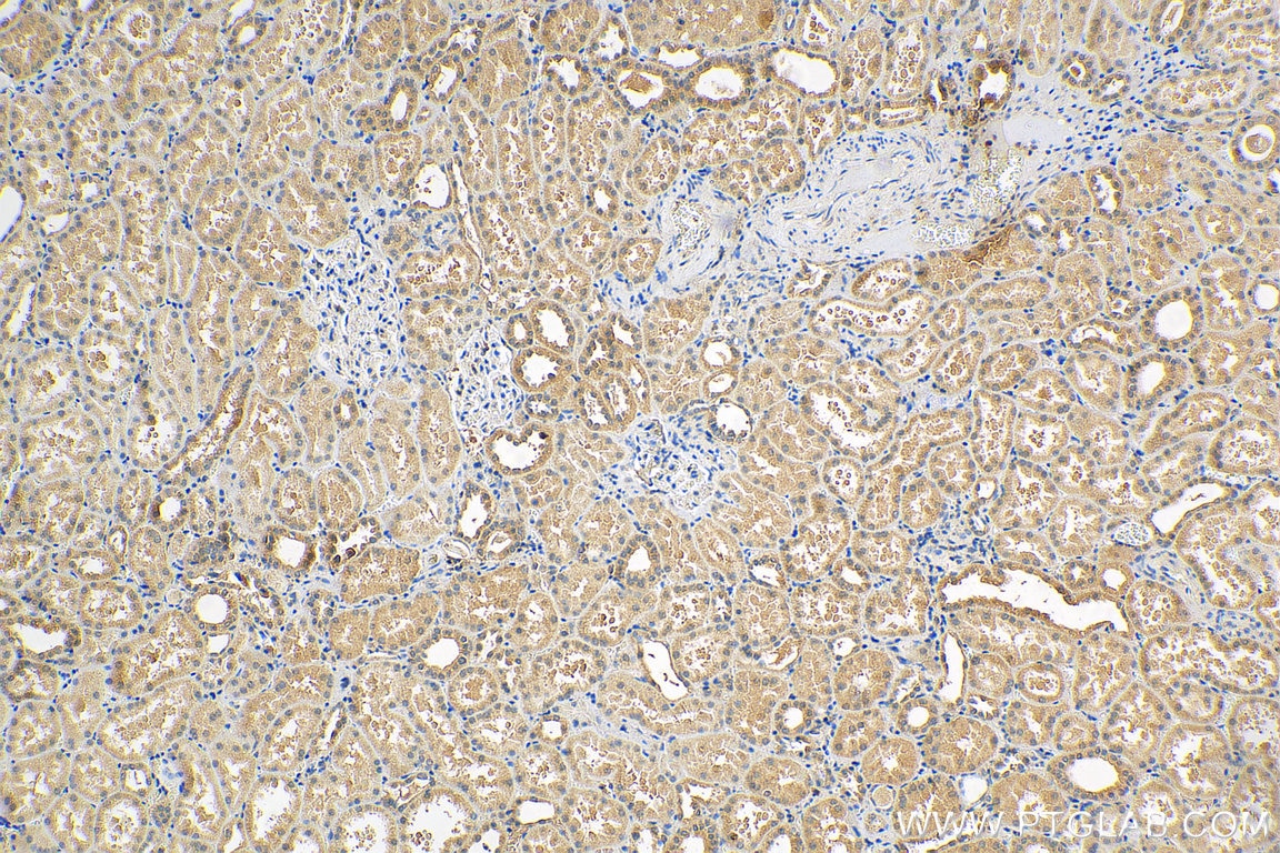 Immunohistochemistry (IHC) staining of human kidney tissue using IL-15RA Polyclonal antibody (16744-1-AP)