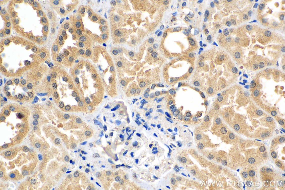 Immunohistochemistry (IHC) staining of human kidney tissue using IL-15RA Polyclonal antibody (16744-1-AP)