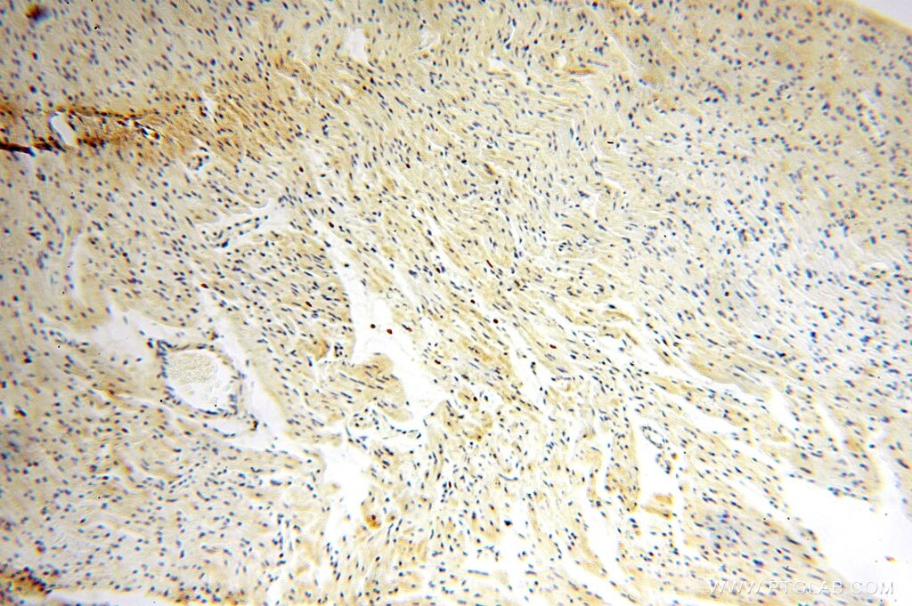 Immunohistochemistry (IHC) staining of human heart tissue using IL-15RA Polyclonal antibody (16744-1-AP)