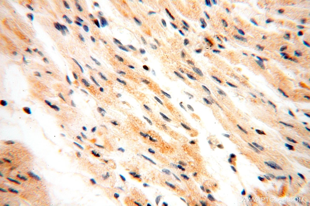 IHC staining of human heart using 16744-1-AP