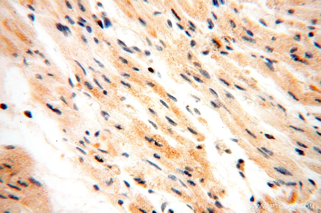 Immunohistochemistry (IHC) staining of human heart tissue using IL-15RA Polyclonal antibody (16744-1-AP)