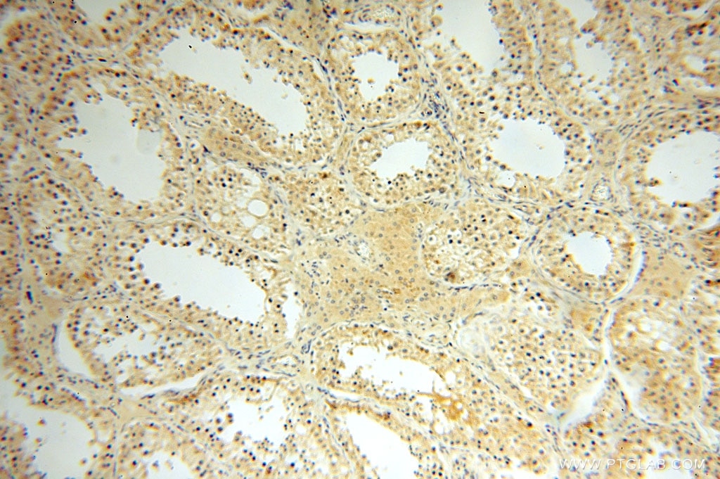 Immunohistochemistry (IHC) staining of human testis tissue using IL-15RA Polyclonal antibody (16744-1-AP)