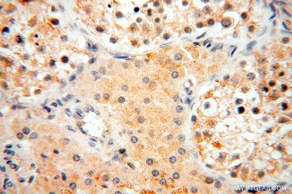 Immunohistochemistry (IHC) staining of human testis tissue using IL-15RA Polyclonal antibody (16744-1-AP)