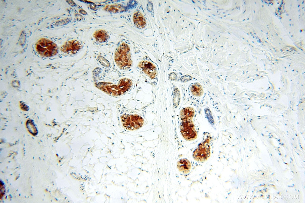 Immunohistochemistry (IHC) staining of human skin tissue using IL-15RA Polyclonal antibody (16744-1-AP)