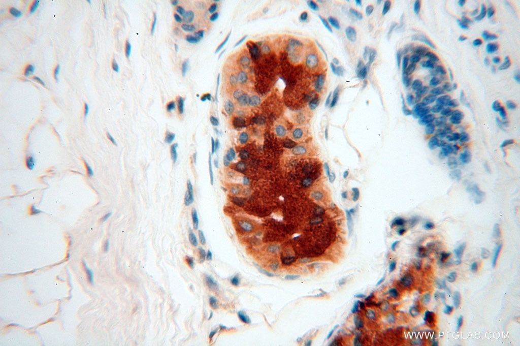 Immunohistochemistry (IHC) staining of human skin tissue using IL-15RA Polyclonal antibody (16744-1-AP)