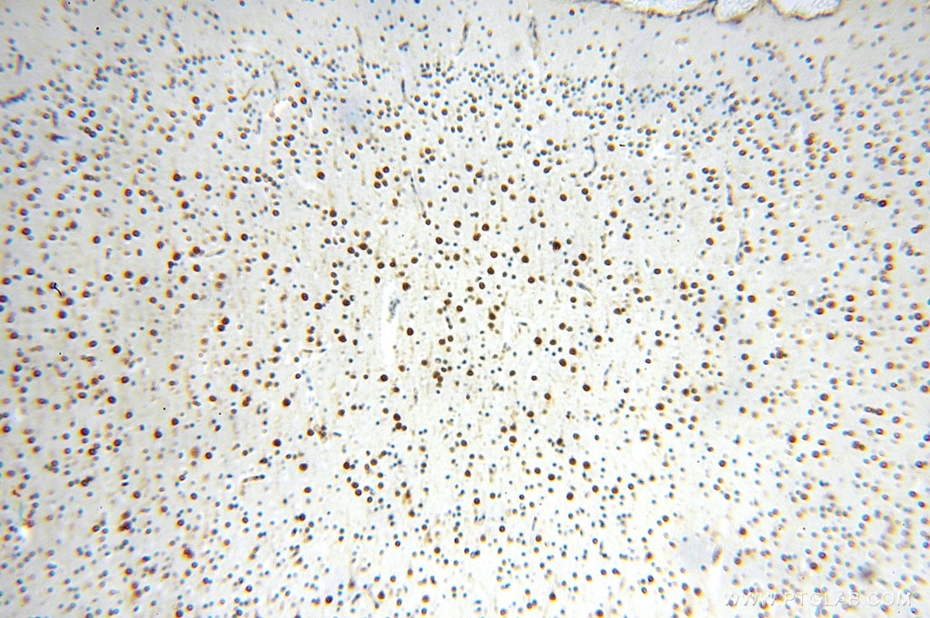 Immunohistochemistry (IHC) staining of human brain tissue using IL-15RA Polyclonal antibody (16744-1-AP)