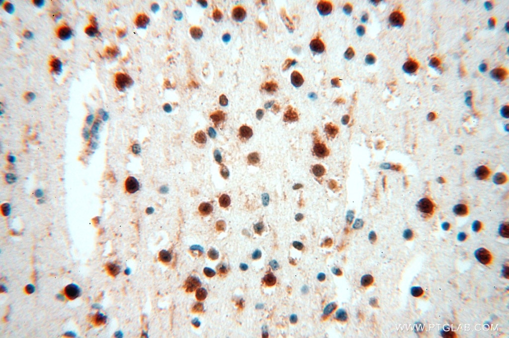 Immunohistochemistry (IHC) staining of human brain tissue using IL-15RA Polyclonal antibody (16744-1-AP)