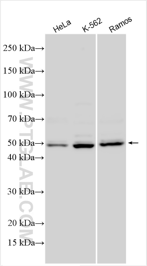 Western Blot (WB) analysis of various lysates using IL-15RA Polyclonal antibody (16744-1-AP)