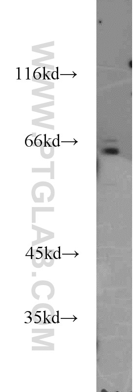 Western Blot (WB) analysis of HeLa cells using IL-15RA Polyclonal antibody (16744-1-AP)