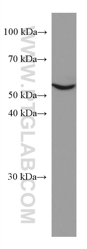 Western Blot (WB) analysis of HeLa cells using IL-15RA Monoclonal antibody (60138-1-Ig)