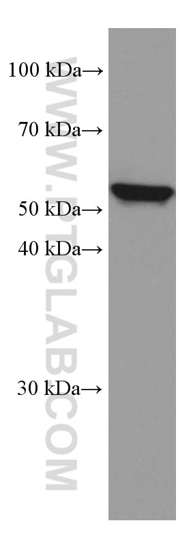 Western Blot (WB) analysis of Raji cells using IL-15RA Monoclonal antibody (60138-1-Ig)