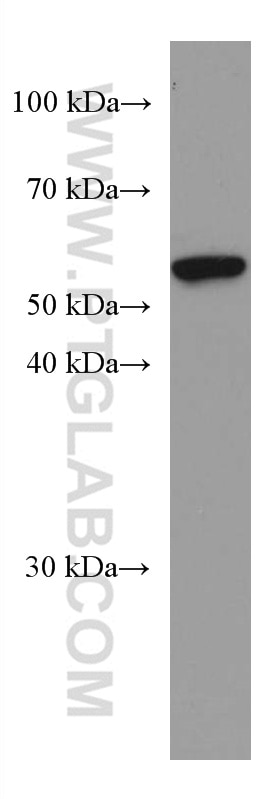 Western Blot (WB) analysis of Daudi cells using IL-15RA Monoclonal antibody (60138-1-Ig)