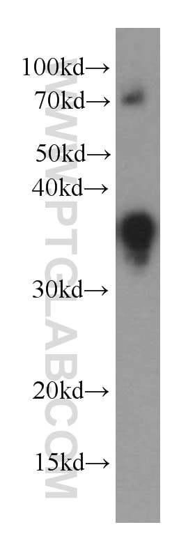 Western Blot (WB) analysis of Recombinant protein using IL-16 Monoclonal antibody (66145-1-Ig)