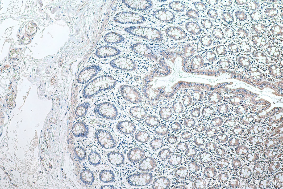 IHC staining of human colon using 13082-1-AP