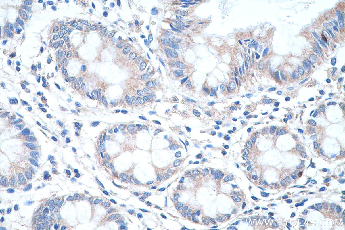 Immunohistochemistry (IHC) staining of human colon tissue using IL-17 Polyclonal antibody (13082-1-AP)