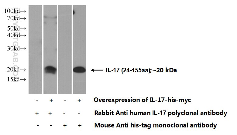 IL-17A Polyclonal antibody