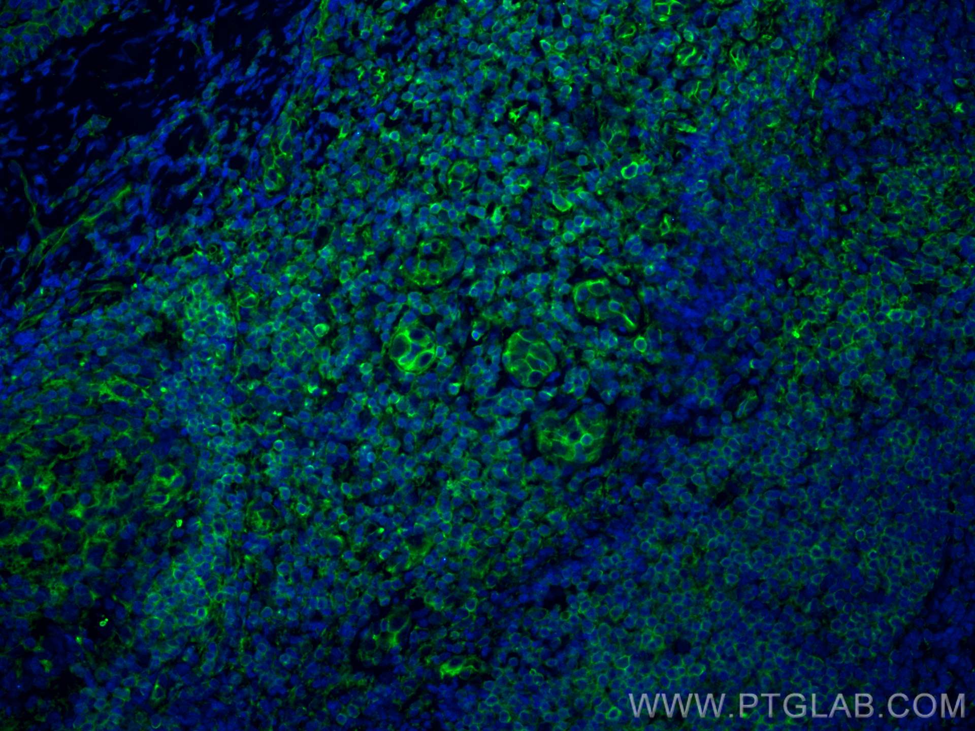 Immunofluorescence (IF) / fluorescent staining of human tonsillitis tissue using IL-17A Monoclonal antibody (66148-1-Ig)