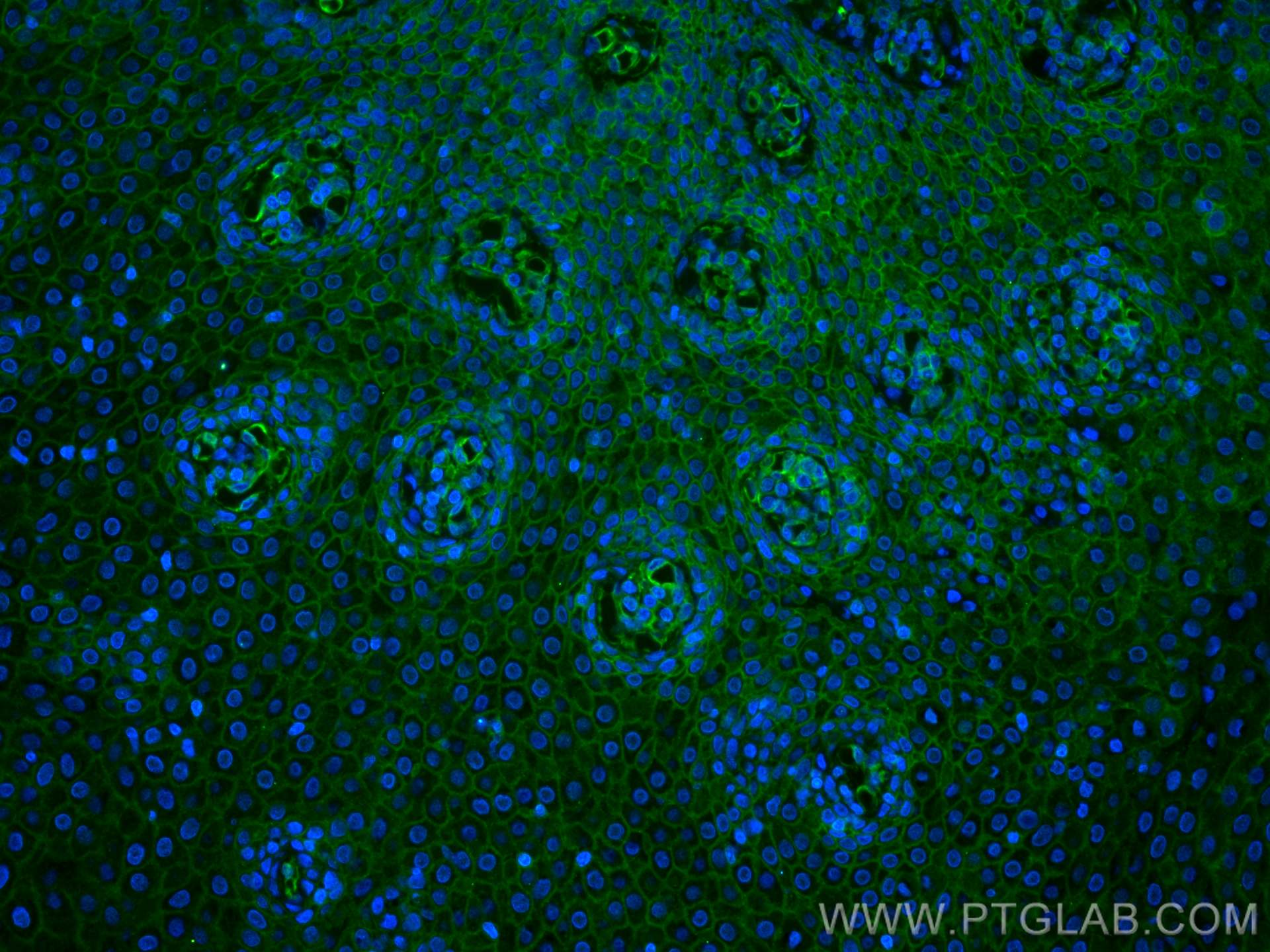 Immunofluorescence (IF) / fluorescent staining of human tonsillitis tissue using IL-17A Monoclonal antibody (66148-1-Ig)